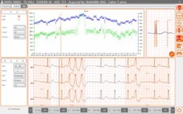 Cardioline Oprogramowanie Cubeholter do holterów Oprogramowanie Cubeholter do holterów Cardioline